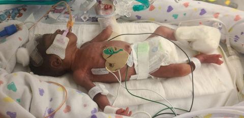 Jermonte's baby Allison after birth